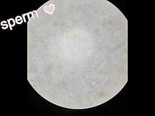 Sperm Observation 1 &lpar;No Abstinence&rpar;