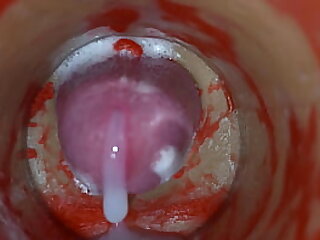 Insemination - Internal Camera Captures Deep Male Ejaculation